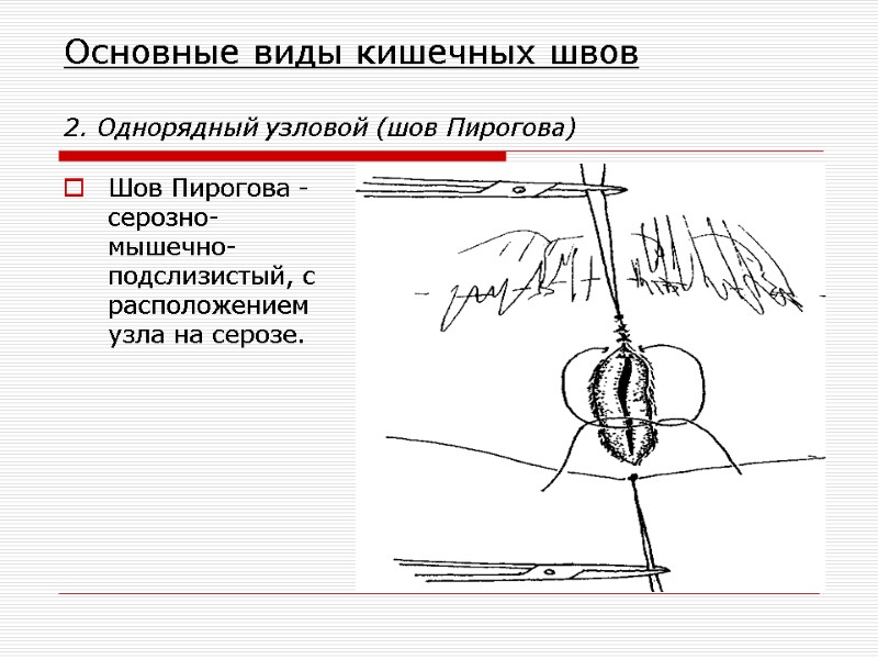 Основные виды кишечных швов  2. Однорядный узловой (шов Пирогова) Шов Пирогова - серозно-мышечно-подслизистый,